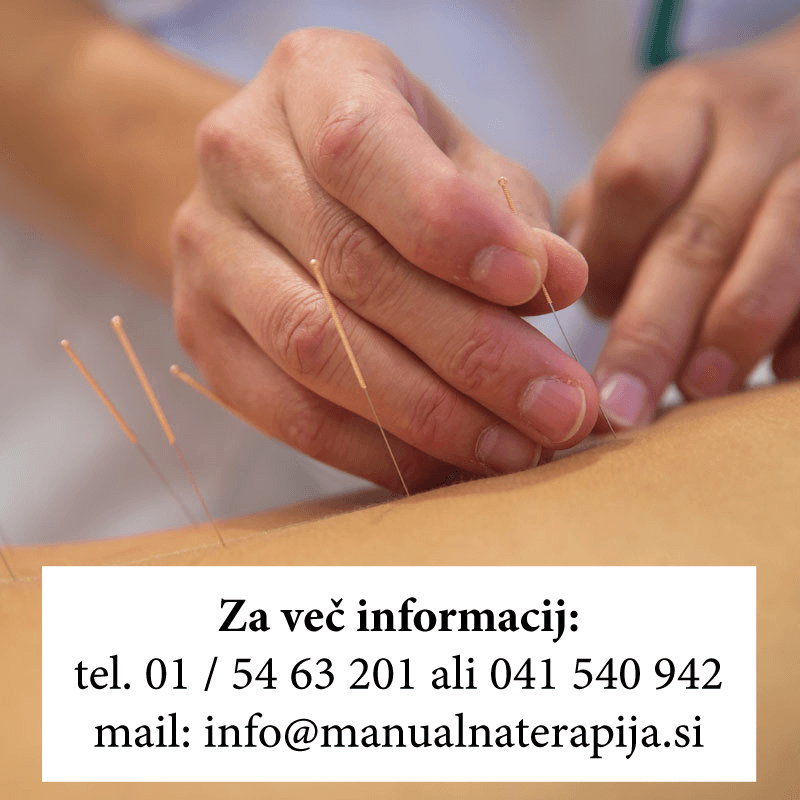Dry Needling